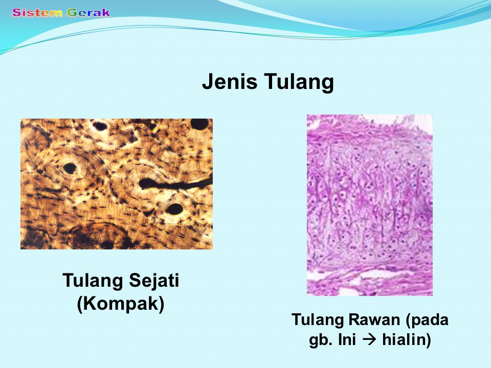 Detail Gambar Tulang Sejati Nomer 21