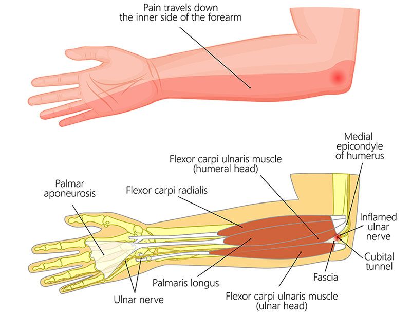 Detail Gambar Tulang Siku Tangan Kiri Nomer 9