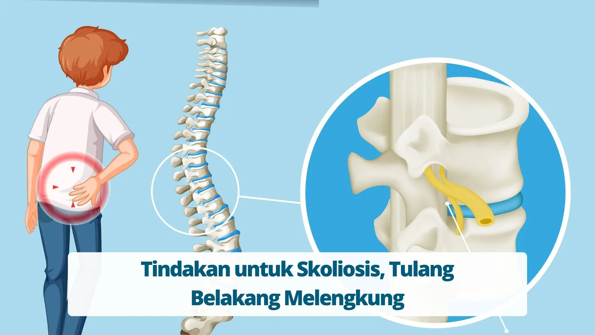 Detail Gambar Tulang Skoliosis Nomer 44