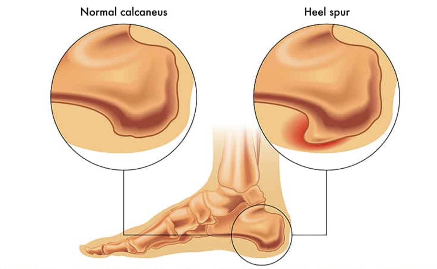 Detail Gambar Tulang Telapak Kaki Nomer 52