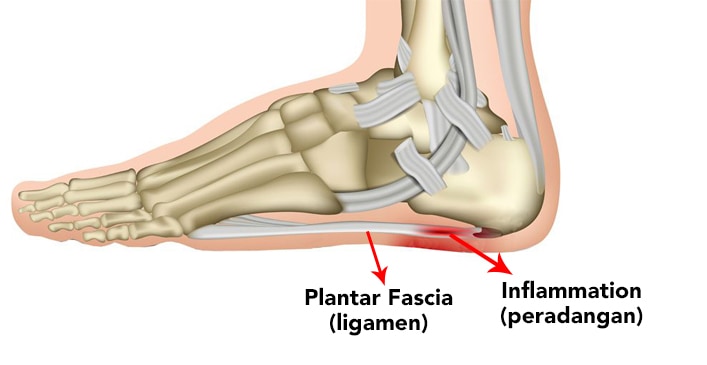 Detail Gambar Tulang Telapak Kaki Nomer 7