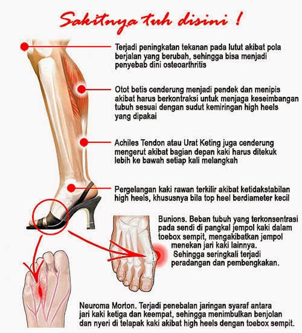 Detail Gambar Tulang Telapak Kaki Nomer 10