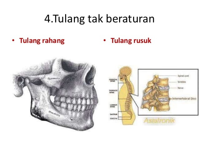 Detail Gambar Tulang Tidak Beraturan Nomer 24