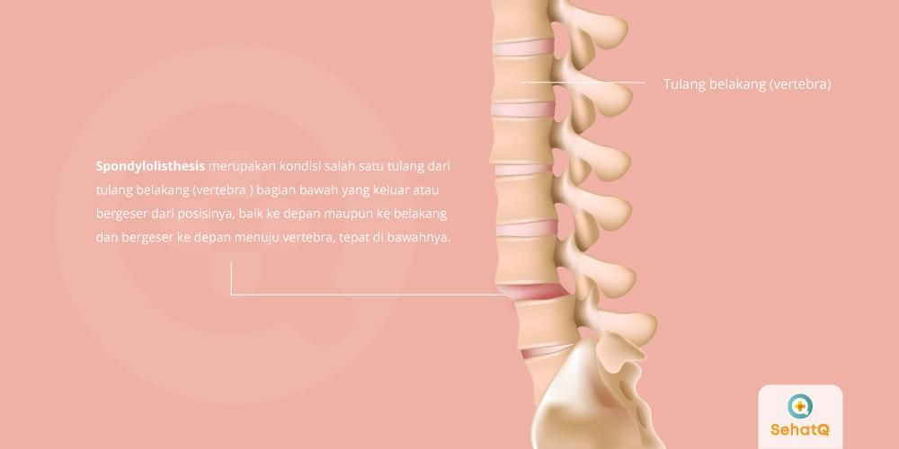 Detail Gambar Tulang Vertebra Nomer 48