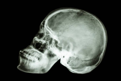 Detail Gambar Tulang Wajah Nomer 32