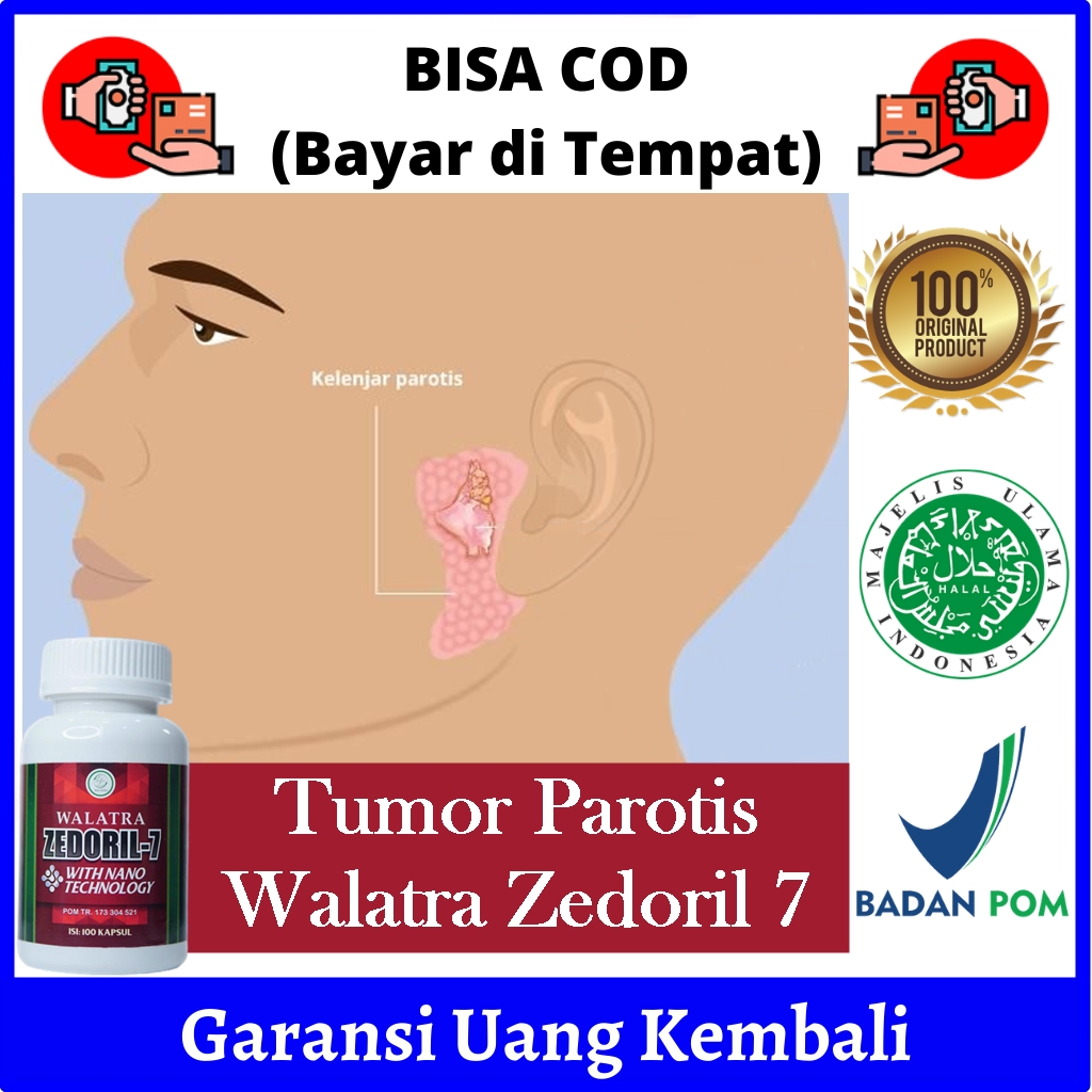 Detail Gambar Tumor Parotis Nomer 52