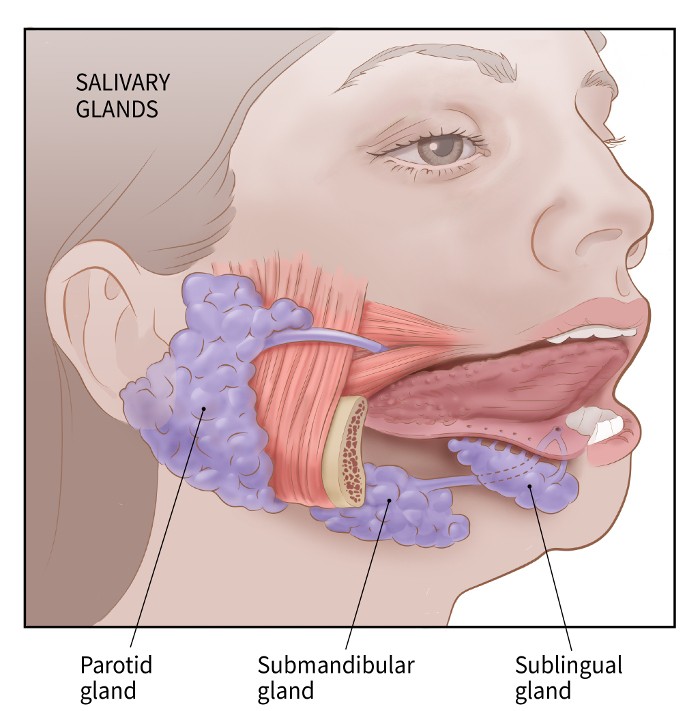 Detail Gambar Tumor Parotis Nomer 54