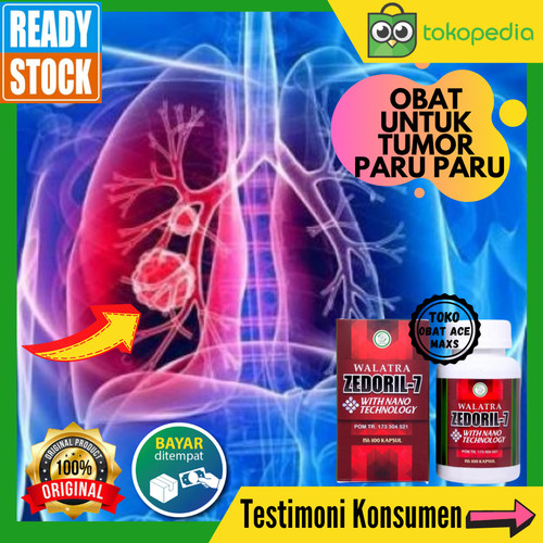 Detail Gambar Tumor Paru Paru Nomer 31