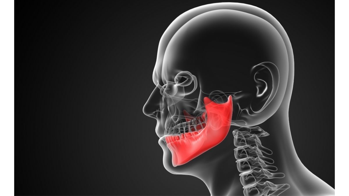 Detail Gambar Tumor Rahang Nomer 7