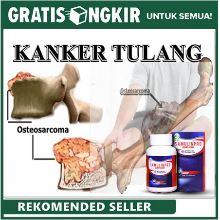 Detail Gambar Tumor Tulang Nomer 47