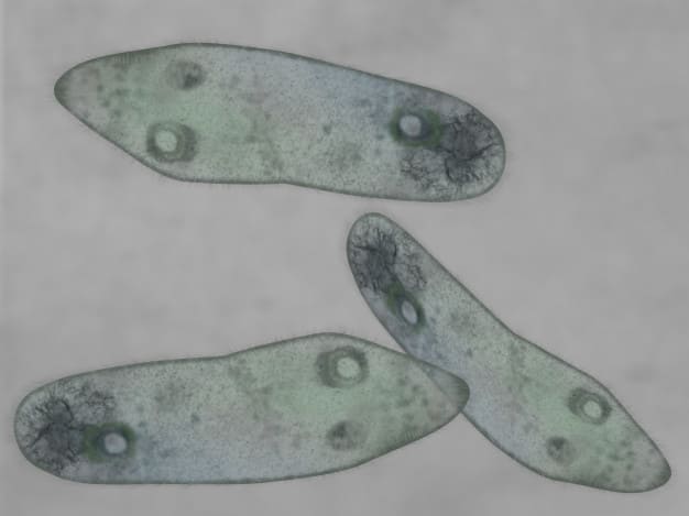 Detail Gambar Turmbuhan Protozoa Nomer 8