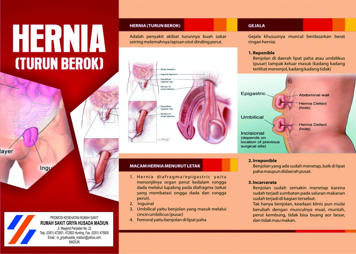 Detail Gambar Turun Berok Nomer 20