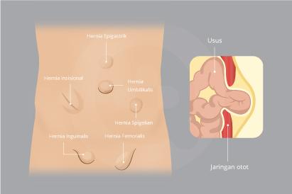 Detail Gambar Turun Berok Nomer 30