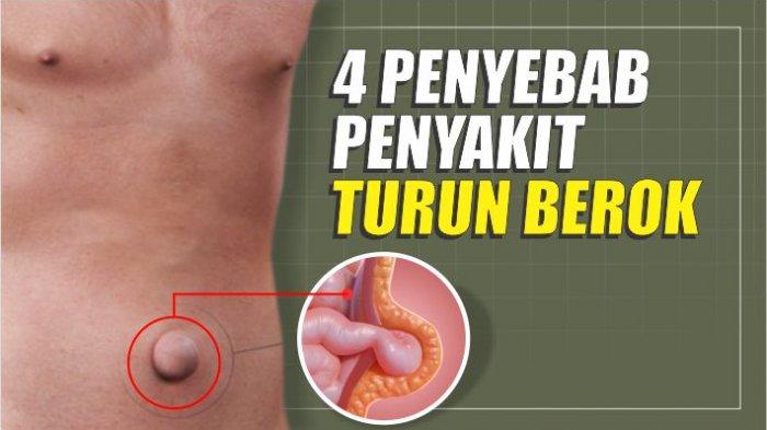 Detail Gambar Turun Berok Nomer 9