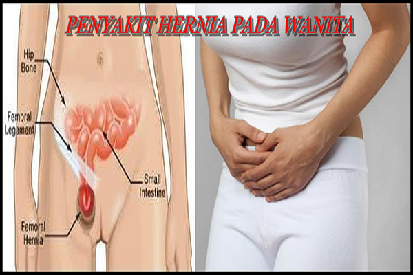 Detail Gambar Turun Berok Pada Wanita Nomer 11