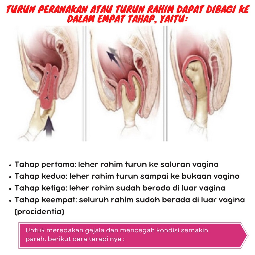 Detail Gambar Turun Berok Pada Wanita Nomer 19