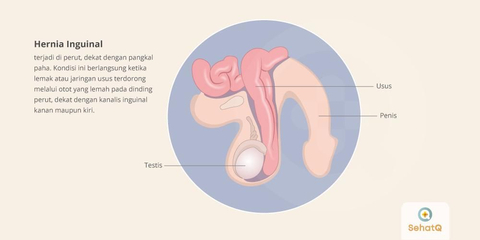 Detail Gambar Turun Berok Pada Wanita Nomer 28