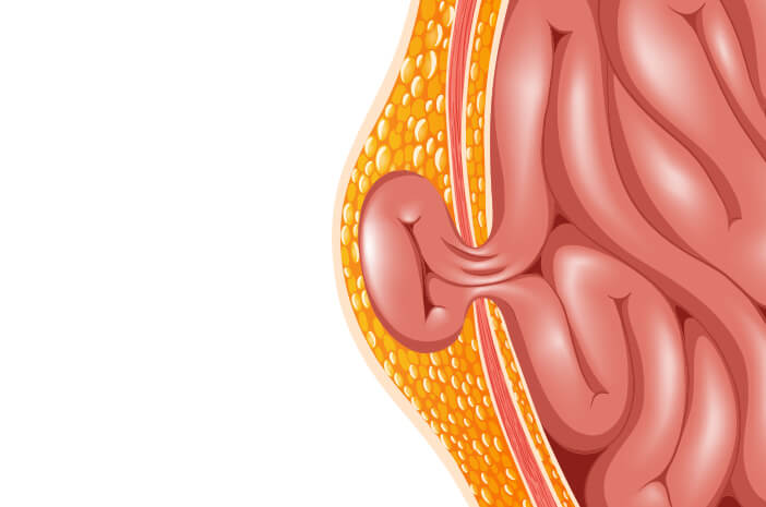 Detail Gambar Turun Berok Pada Wanita Nomer 50