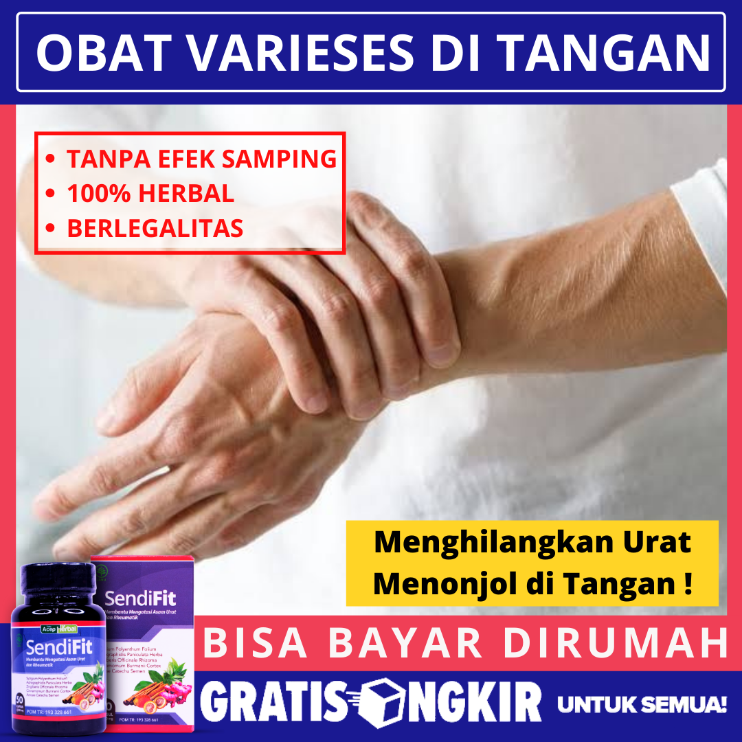 Detail Gambar Urat Tangan Nomer 44