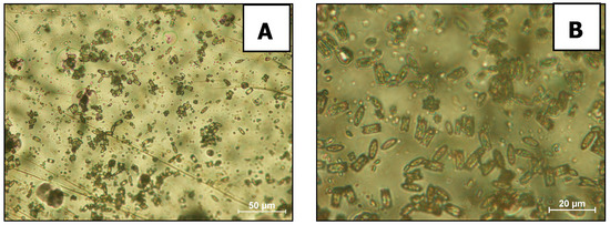 Detail Gambar Uric Acid Dalam Sedimen Urin Nomer 25