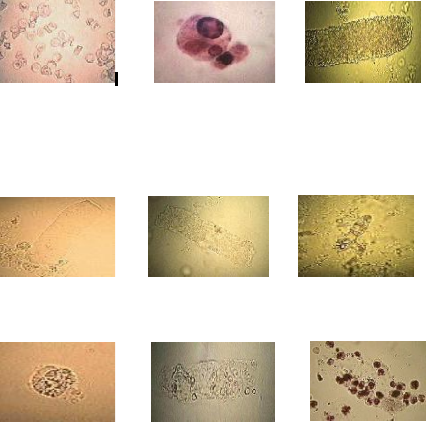 Detail Gambar Uric Acid Dalam Sedimen Urin Nomer 37