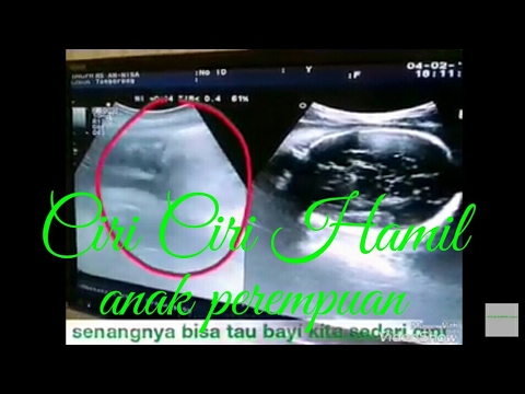 Detail Gambar Usg Anak Perempuan Nomer 51