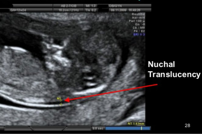 Detail Gambar Usg Bayi Nomer 56