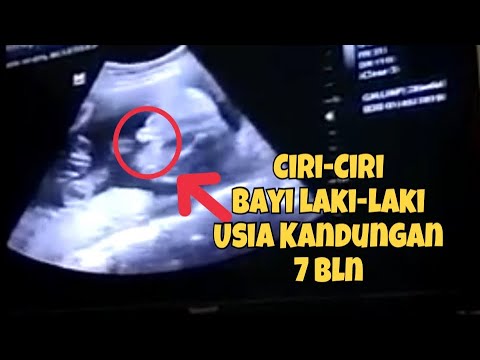 Detail Gambar Usg Bayi Perempuan Nomer 37