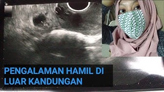 Detail Gambar Usg Hamil Diluar Kandungan Nomer 13