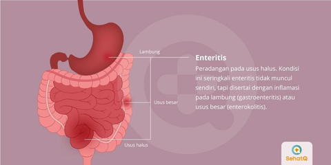 Detail Gambar Usus Besar Dan Usus Halus Nomer 41