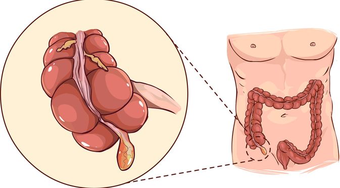 Detail Gambar Usus Besar Tanpa Keterangan Nomer 29