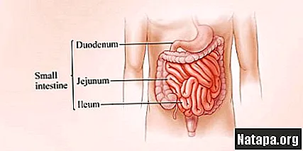 Detail Gambar Usus Halus Dan Usus Besar Nomer 38