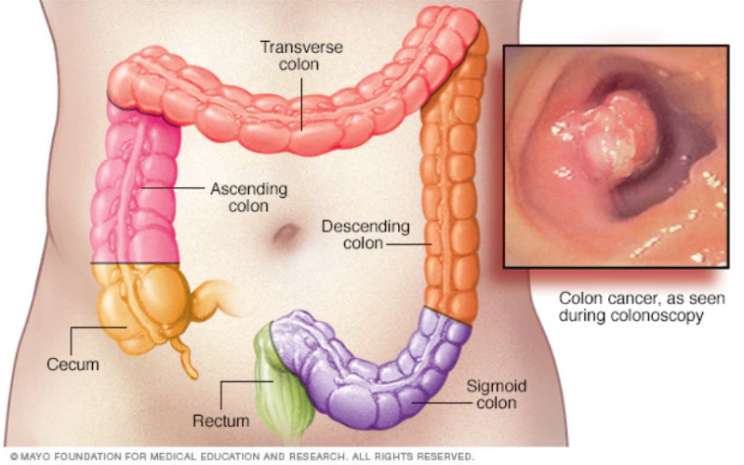 Detail Gambar Usus Halus Tanpa Warna Nomer 14