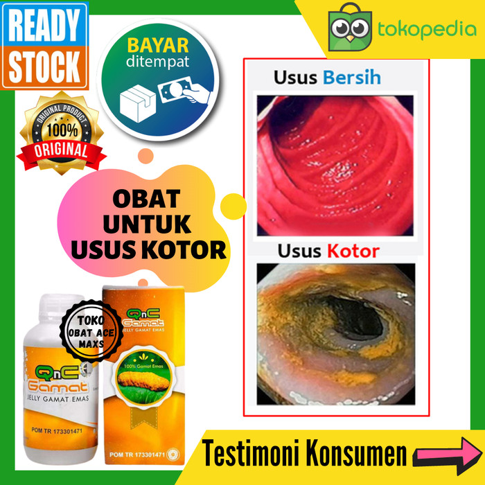 Detail Gambar Usus Kotor Nomer 14