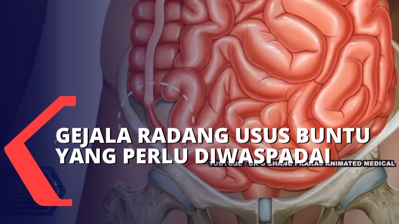 Detail Gambar Usus Turun Nomer 26