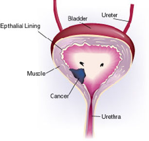 Detail Gambar Vesika Urinaria Nomer 13