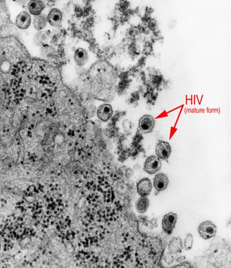 Detail Gambar Virus Hiv Nomer 24