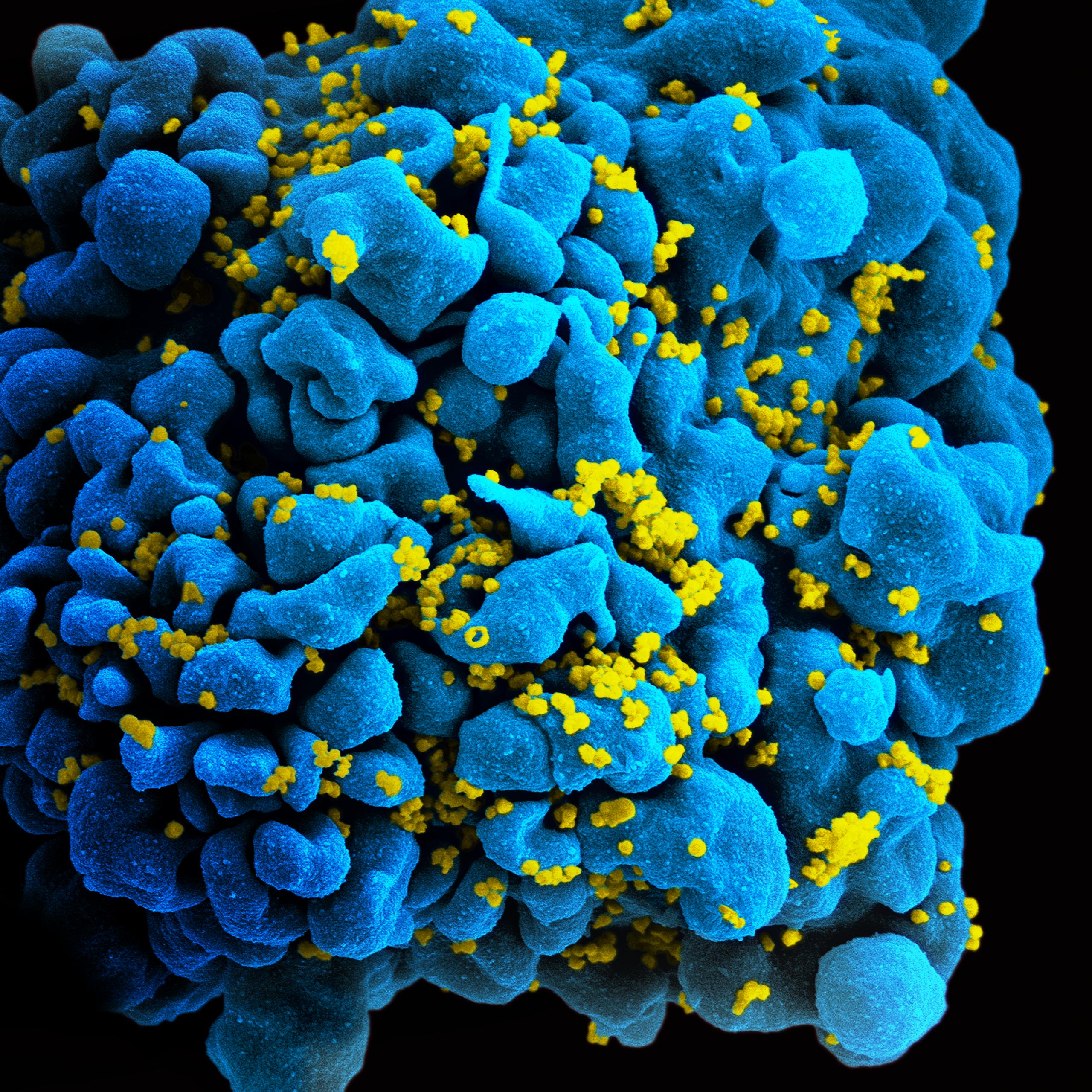 Detail Gambar Virus Hiv Nomer 30
