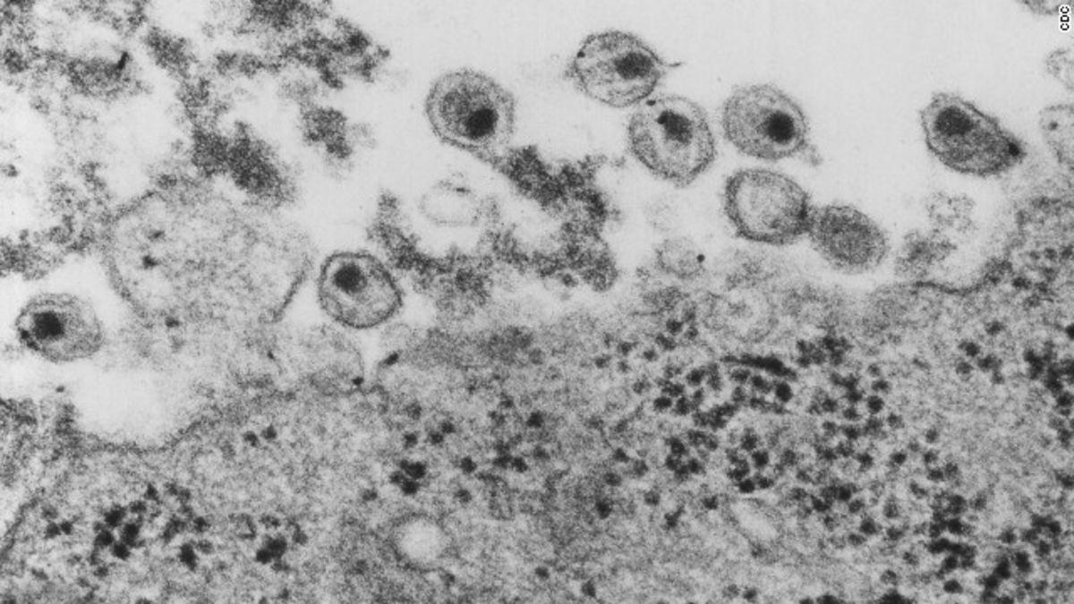 Detail Gambar Virus Hiv Nomer 36