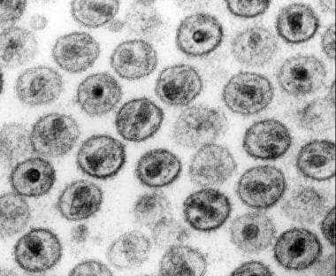 Detail Gambar Virus Hiv Nomer 54