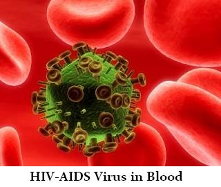 Detail Gambar Virus Penyakit Hivaids Nomer 10