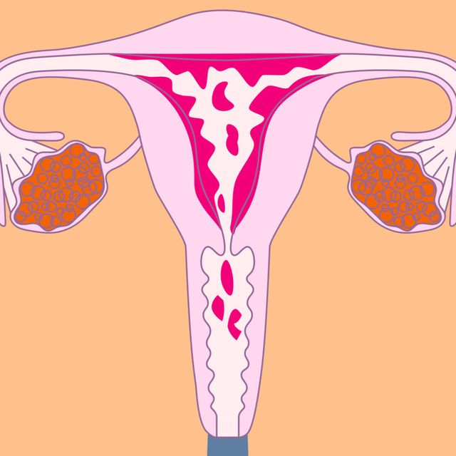 Detail Gambar Wanita Menstruasi Nomer 23