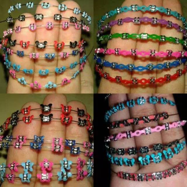 Detail Gambar Warna Behel Yg Cantik Nomer 47