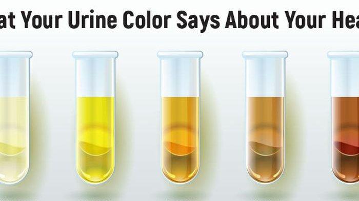 Detail Gambar Warna Urine Nomer 14