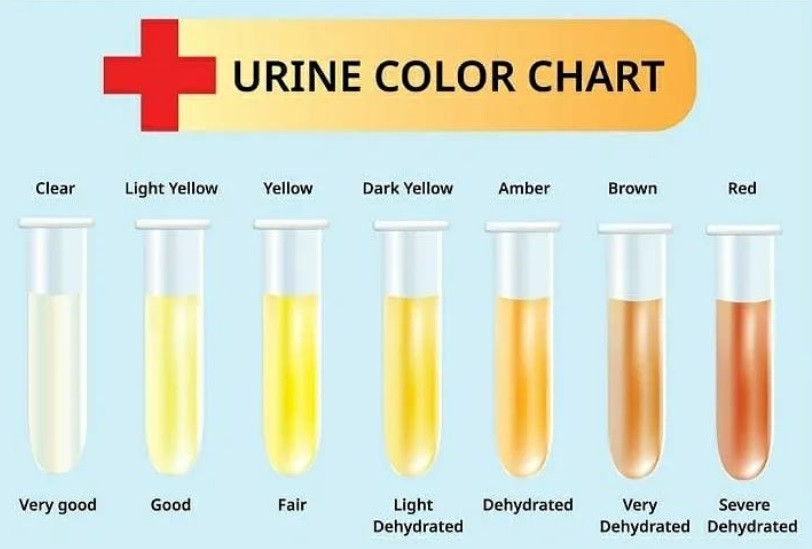 Detail Gambar Warna Urine Nomer 35