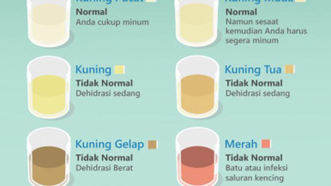 Detail Gambar Warna Urine Nomer 8