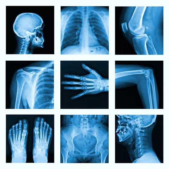 Detail Gambar X Ray Nomer 5