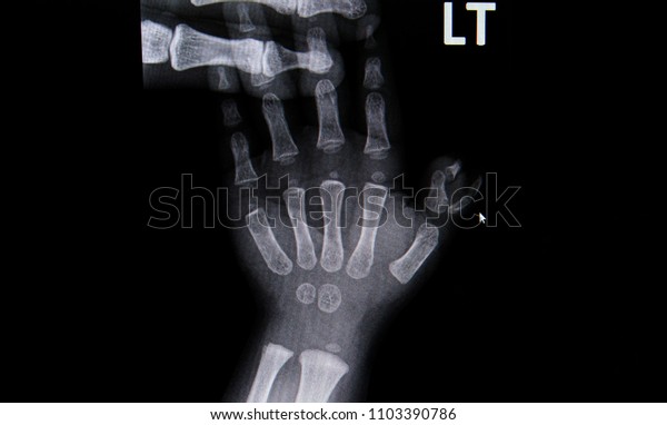 Detail Gambar X Ray Nomer 42