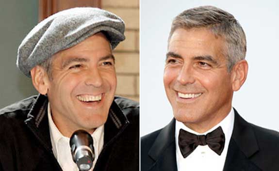 Detail George Clooney Veneers Nomer 17