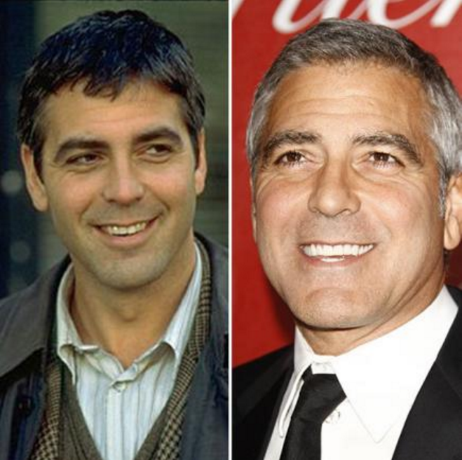 Detail George Clooney Veneers Nomer 4